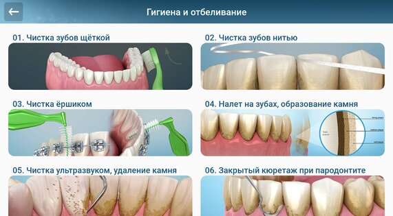 Стоматология - 3D иллюстрации 2.1.101. Скриншот 11