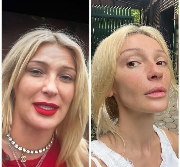 Настя Ивлеева до и после