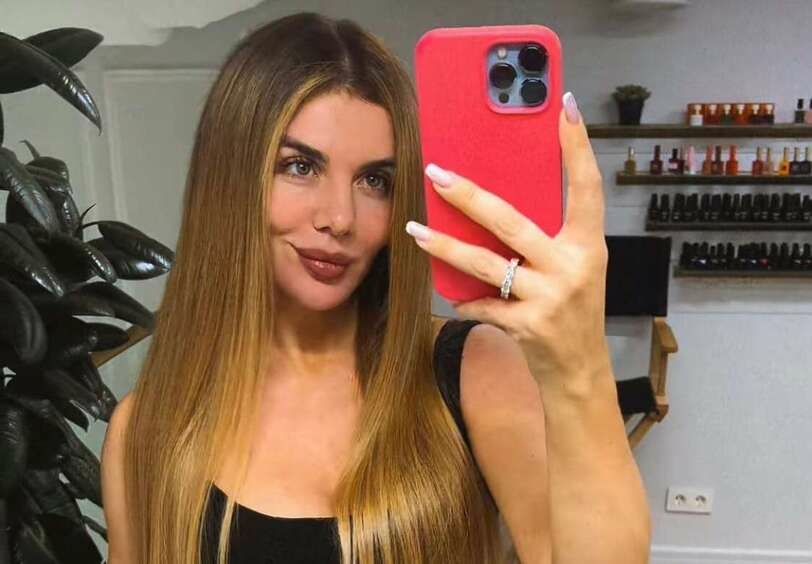 Анна Седокова «превратилась в Шрека»: шокирующие фото певицы