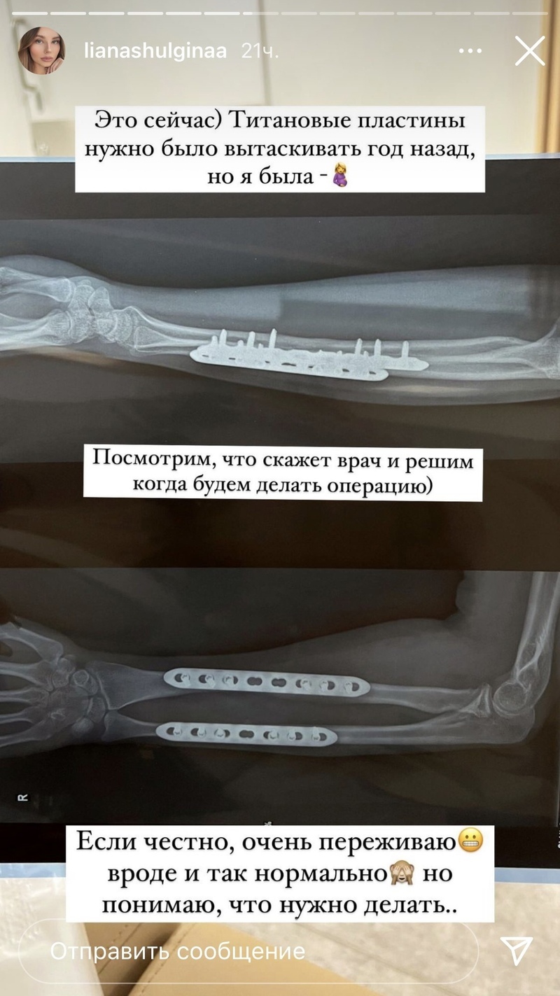 Из-за беременности девушке пришлось отложить операцию