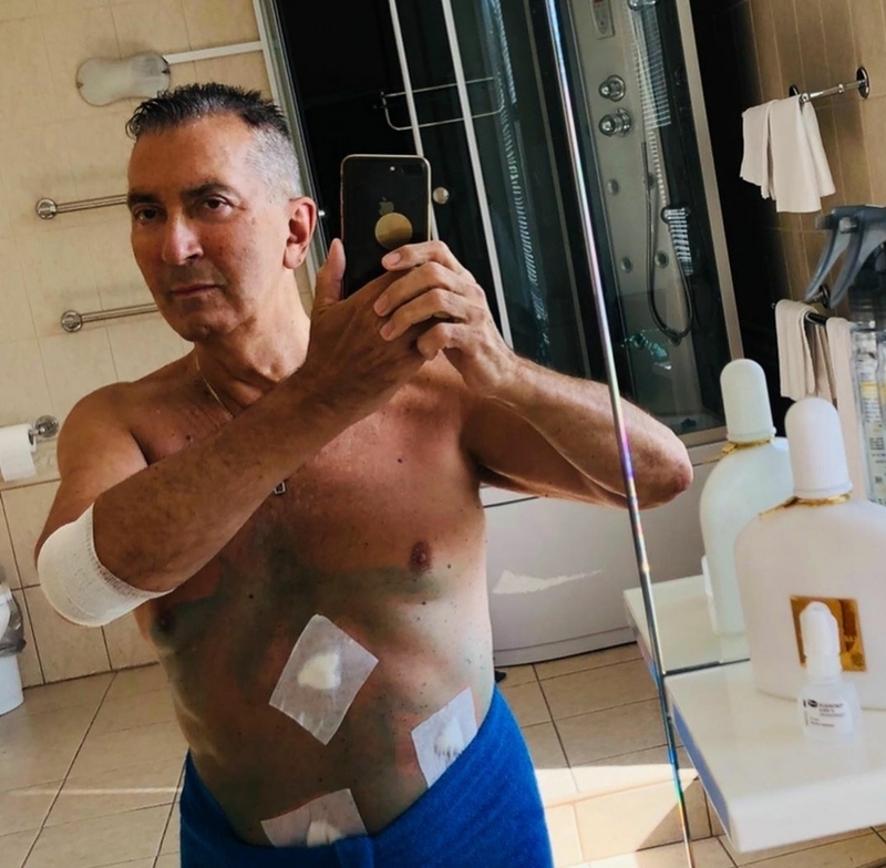 Певцу удалили желчный пузырь