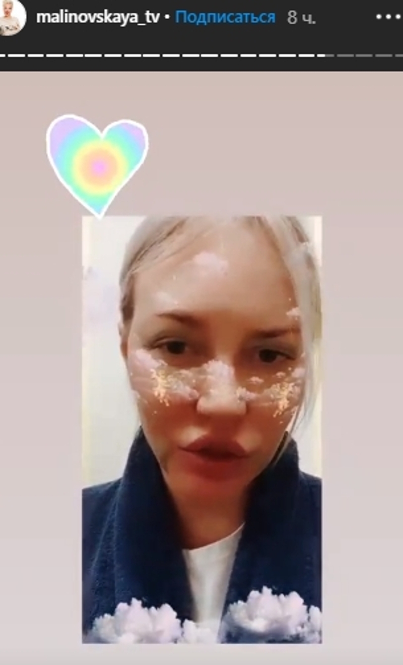 Малиновская решилась на омолаживающую пластику