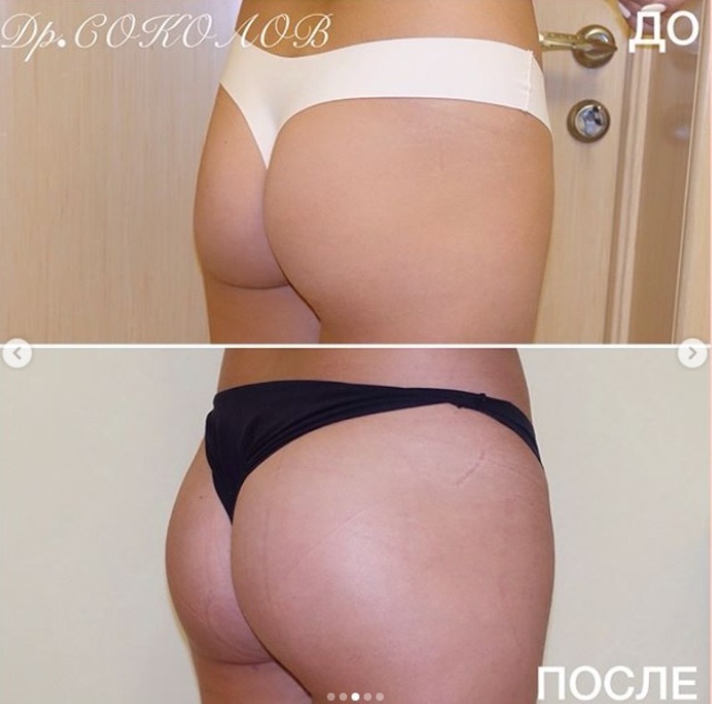 До и после