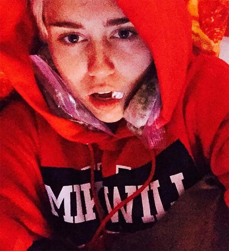 Майли Сайрус решила удалить сразу четыре зуба мудрости. Фото: Instagram.com/mileycyrus.