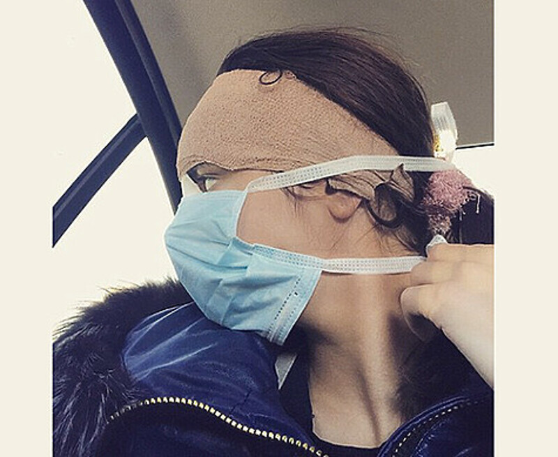 Три недели назад. aliana1001: «Наконец-то еду снимать этот гипс … неделя была нелегкой, зато сейчас увижу результат!!!! так интересно». Фото: Instagram.com/aliana1001.