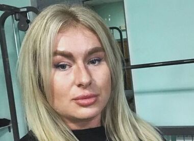 «Сильный отек лица»: дочь-бодибилдерша Шукшиной заработала проблемы со здоровьем