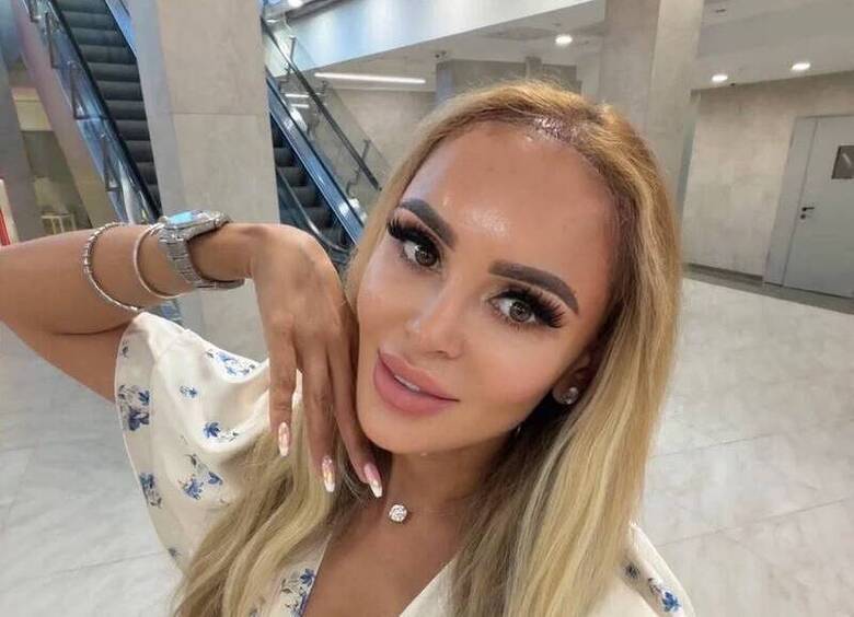 Анна Калашникова сделала пересадку волос